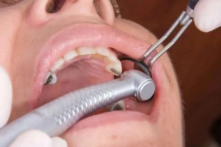 دندانپزشکی تجهیزات دندانپزشک