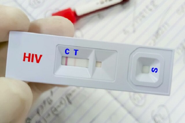 درمان «ایدز» رایگان است/ ویروس HIV قابل کنترل است به شرط درمان