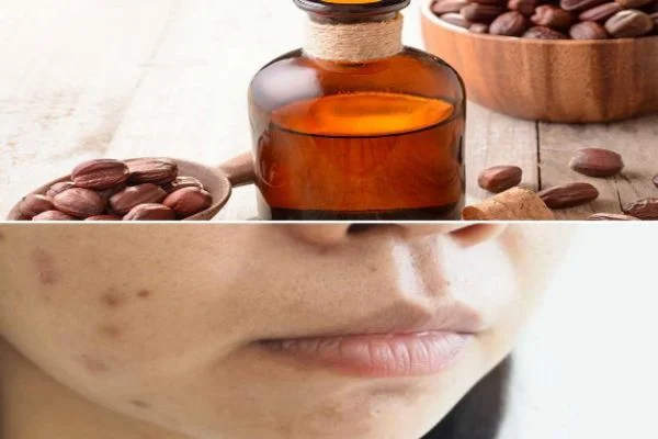 روغن جوجوبا برای لک صورت | روش های موثر در رفع لک های پوستی