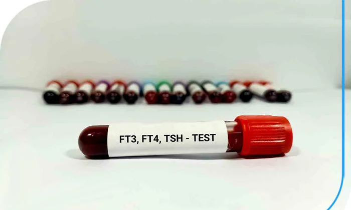 T4 در آزمایش خون چیست؟ + تفسیر آزمایش T4