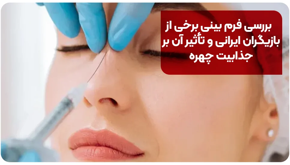 پوست بررسی فرم بینی برخی از بازیگران ایرانی و تأثیر آن بر جذابیت چهره