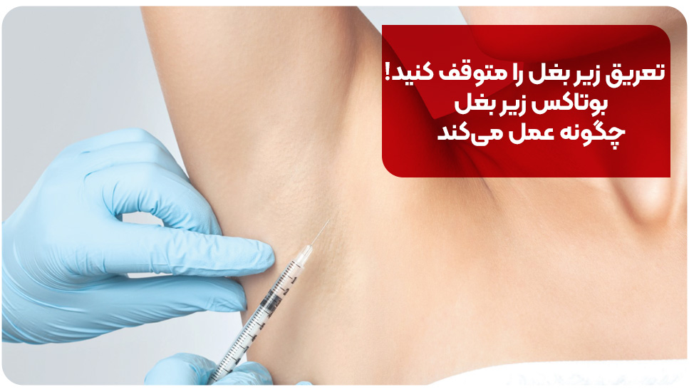 تعریق زیر بغل را متوقف کنید! بوتاکس زیر بغل چگونه عمل می کند
