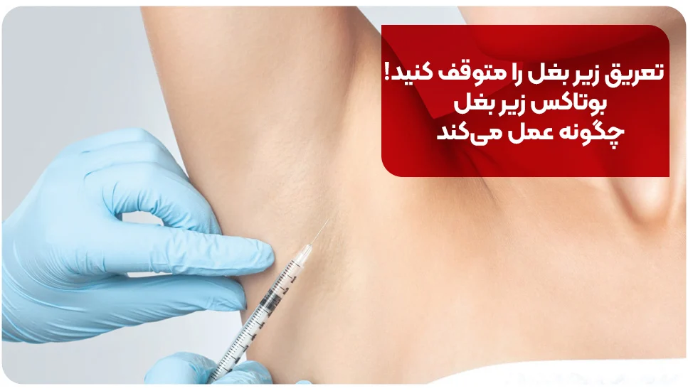 تعریق زیر بغل را متوقف کنید! بوتاکس زیر بغل چگونه عمل می کند