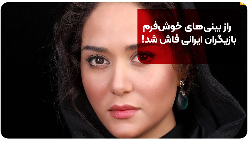 راز بینی های خوش فرم بازیگران ایرانی فاش شد!