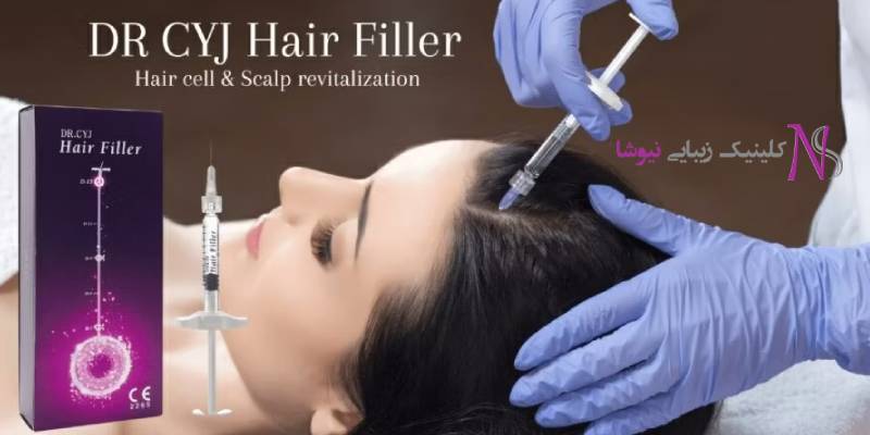 با هیرفیلر دوباره موهای پرپشت و سالم داشته باشید