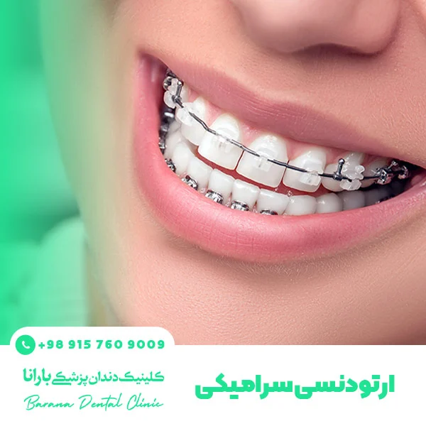 انواع ارتودنسی دندان + راهنمای انتخاب بهترین روش