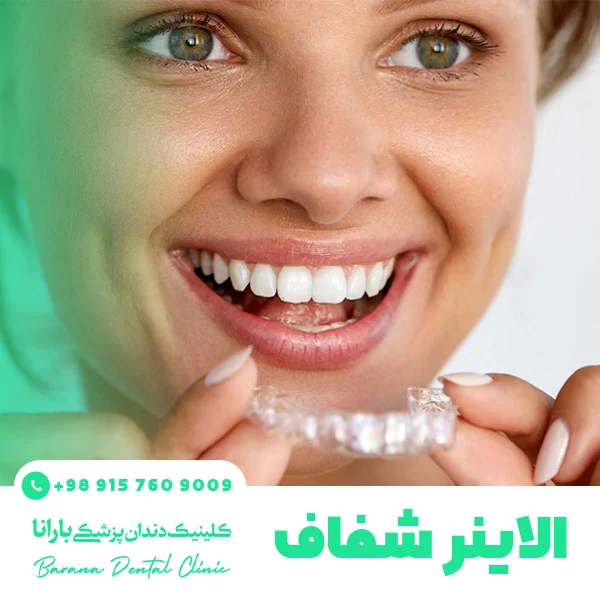 انواع ارتودنسی دندان + راهنمای انتخاب بهترین روش