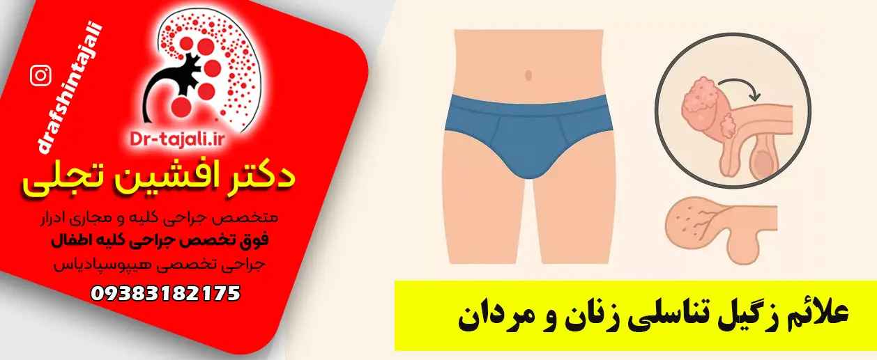مرکز درمان زگیل تناسلی در اصفهان|دکتر افشین تجلی