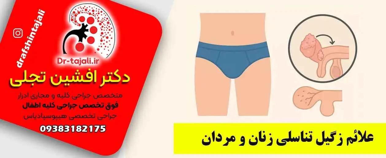 درمان | درمان زگیل تناسلی مرکز درمان زگیل تناسلی در اصفهان|دکتر افشین تجلی