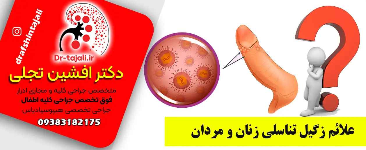 مرکز درمان زگیل تناسلی در اصفهان|دکتر افشین تجلی