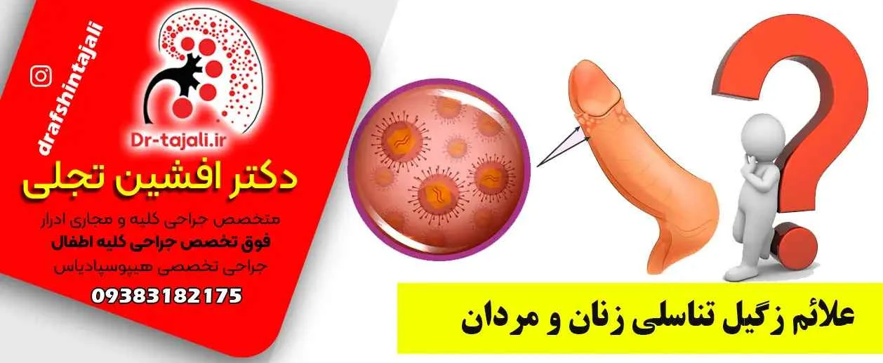 درمان | درمان زگیل تناسلی مرکز درمان زگیل تناسلی در اصفهان|دکتر افشین تجلی