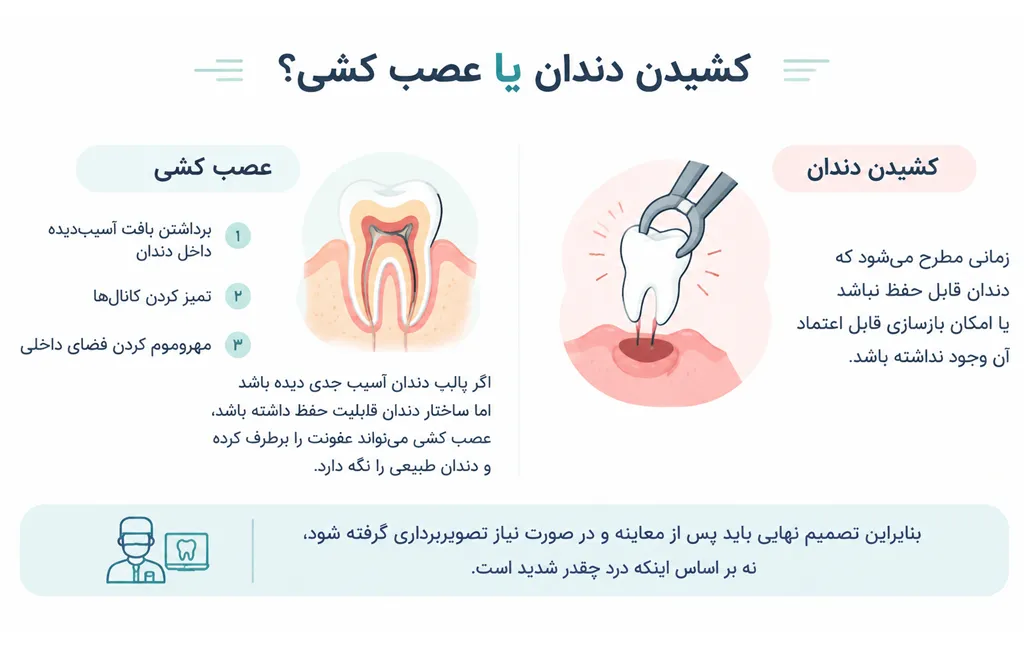 دندانپزشکی | ایمپلنت کشیدن دندان یا عصب کشی؟